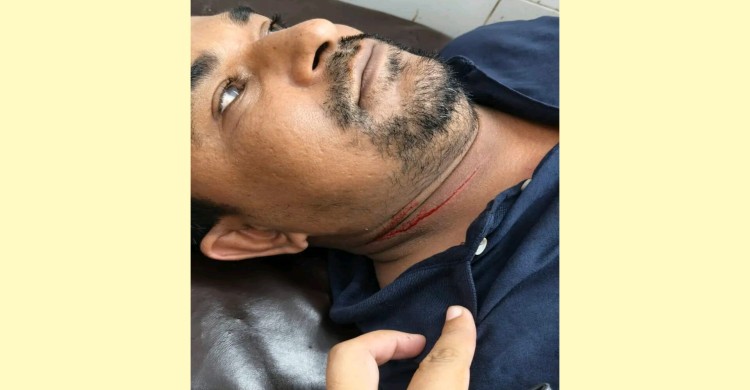 মাদকের প্রতিবাদ করায় স্বেচ্ছাসেবক দল নেতা তারেকের ওপর হামলা